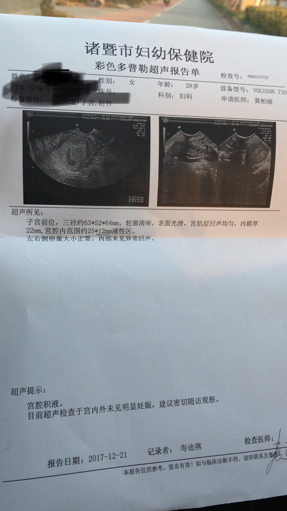 三个月排出的孕囊图片，揭示早期妊娠的微妙变化